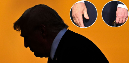 Trump sufre de insuficiencia venosa crónica, según un informe médico de la Casa Blanca