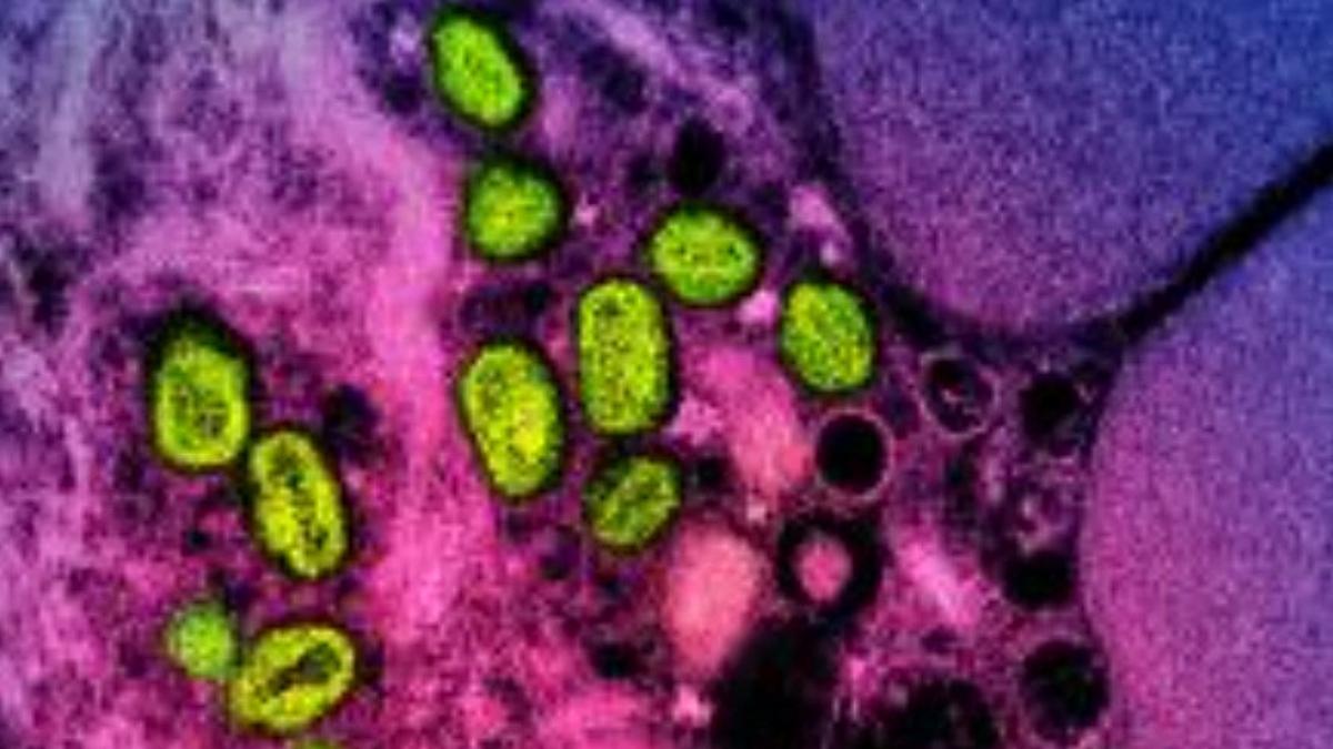 España notifica la primera muerte por mpox, la viruela del mono desde 2022